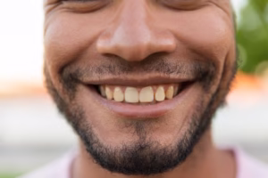 How to Get Rid of Yellow Teeth: A Complete Guide to Removing Stains and Restoring Your Bright Smile
